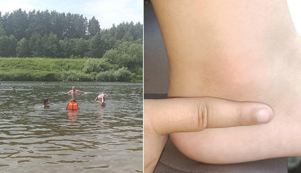 Теперь мошки и прочие кусачие насекомые не испортят отдых на речке