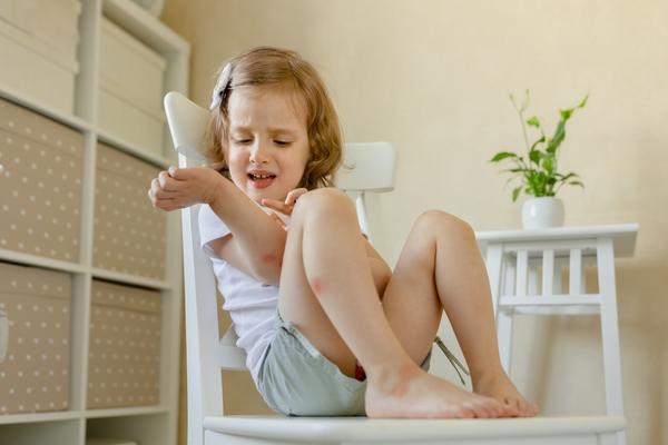 Комариные укусы вызывают сильный дискомфорт