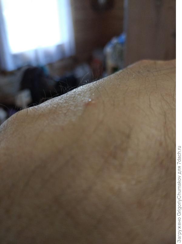 Пузырек водинистый. Это явно борщевик расписался