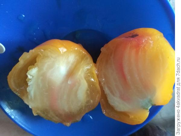 Сердце из Цинциннати в разрезе.