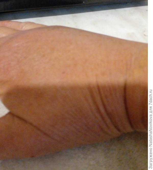 муравьи накусали...собаки...