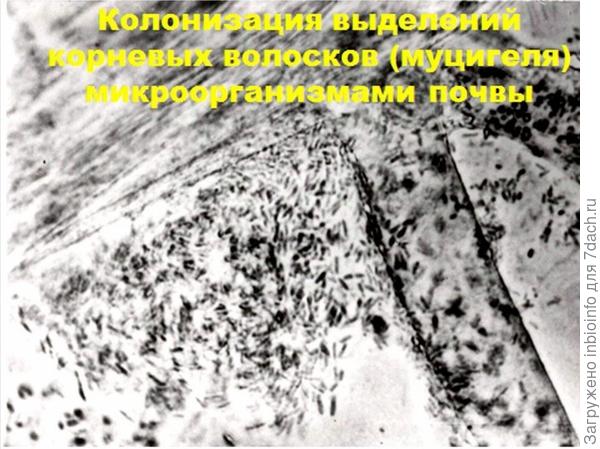 Микрофотография. Выделенные корешком гели активно заселяются микроорганизмами.