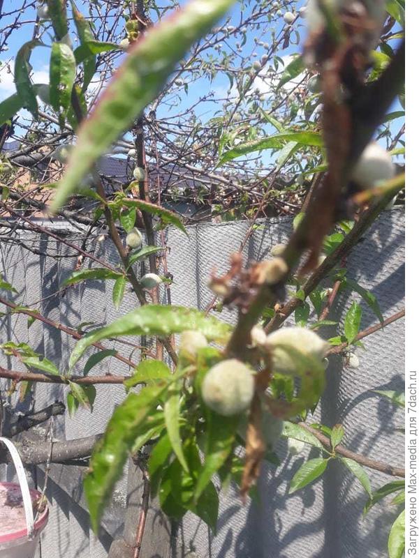 Как лечить?