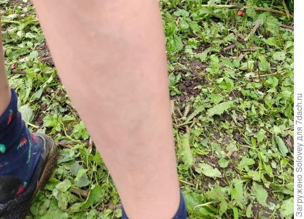 После применения крема тоже нет ни одного укуса