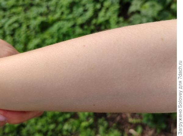 Укусов не наблюдается